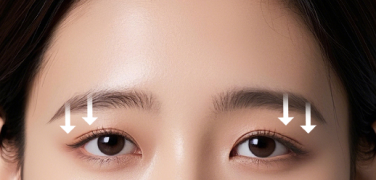 Droopy eyebrows making the eyes look heavy