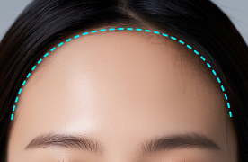 Wide forehead